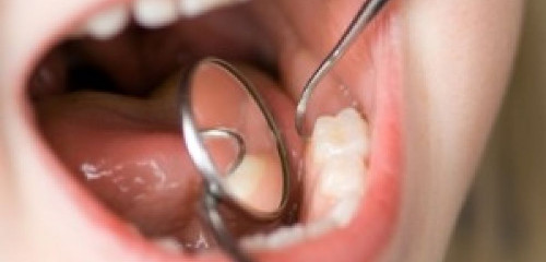 mantenimento_figli_spese_mediche_dentista